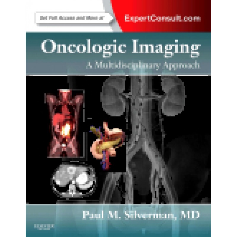 Oncologic Imaging: A Multidisciplinary Approach
